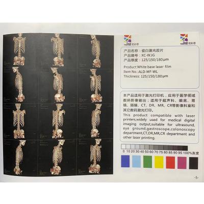 China Medical printing like single paper medical film A4 film white report ultrasound factoyt direct selling laser china printing for sale