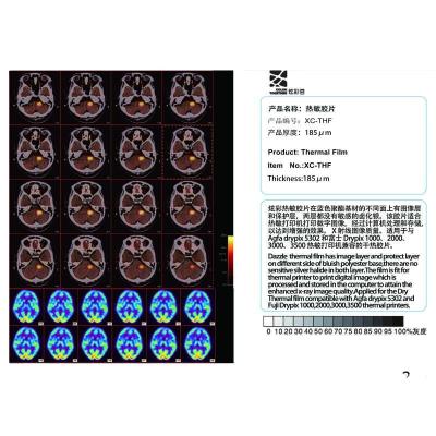 China Dry Medical Printing Film Antibacterial Thermal Medical Fog Stocking Film For Thermal Printers for sale