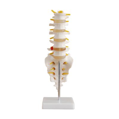 China Hot sale life size lumbar vertebrae teaching model with sacrum and coccyx and herniated disc for demonstration for sale