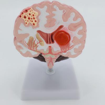 China Durable pathological anatomical model of human brain, medical human brain model for medical teaching for sale