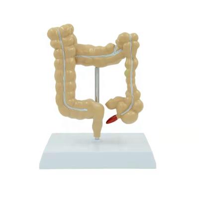 China High Quality Education Colon Pathology Model For Teaching Visceral Anatomical Model Model for sale