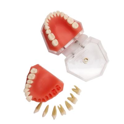 China Durable Mouth Full Teeth Removable Soft Gum Model Oral Model With 28 Teeth for sale