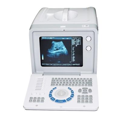 China 10-Inch Portable Digital Ultrasound Machine Scanner Convex Linear 2 Probes 3D CE for sale