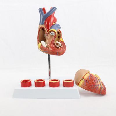 China PVC Heart Model Attach Diseased Artery Vas Durable Human Model Thrombus Teaching Model for sale