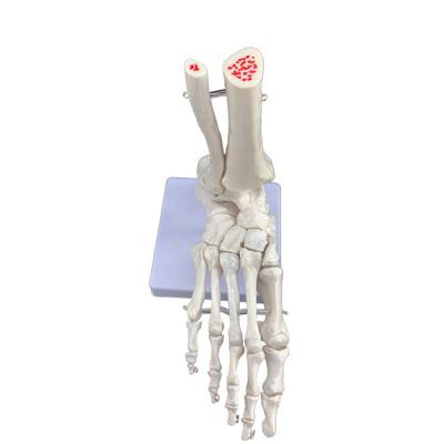 China Durable Life Size Foot Anatomical Model joint skeletal anatomical model for sale