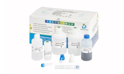 China Economical Sperm DNA Fragmentation Test Kit For DNA Fragmentation Level Determination--sperm chromatin dispersion method for sale