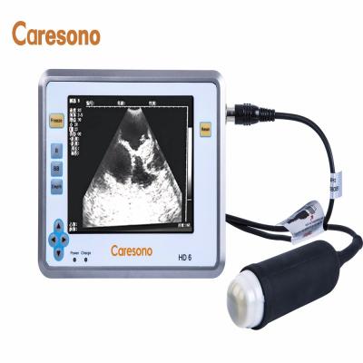 China All pregnancy diagnosis: sows; cows ; sheep; Caresono Small Ruminants Area Mechanical Ultrasound Machine Waterproof Probe For Animal Pregnancy Testing for sale