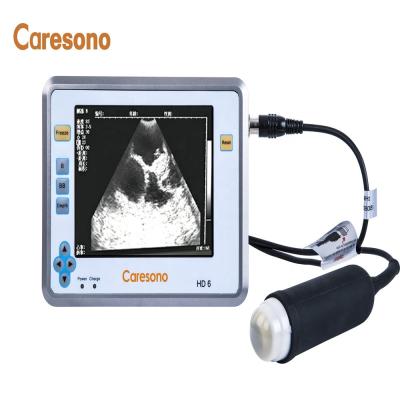 China All pregnancy diagnosis: sows; cows ; sheep; 2020 Goats And Small Ruminants Home Animal Handheld Ultrasound Scanner For Pregnant Pig for sale