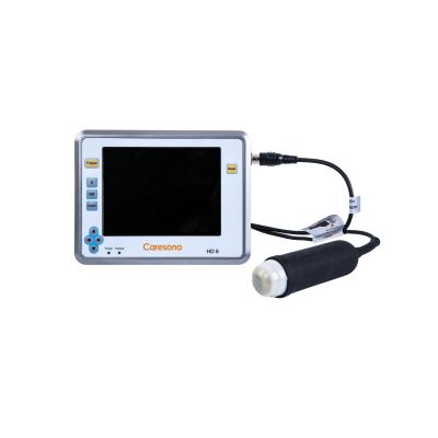 China Pregnancy Diagnosis Caresono Palm Ultrasound Scanning With Mechanical Sector 35mhz Scanning Probe for sale