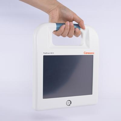 China Bladder best-selling scanner biocon resin products professional manufacturer sale for sale