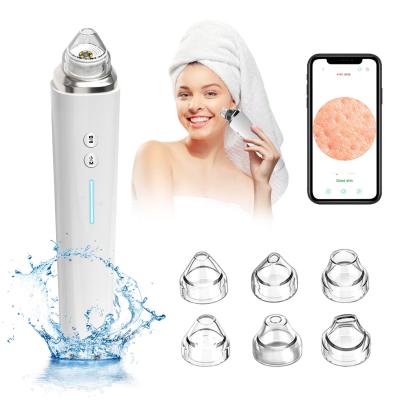 China Timesiso H100 20X Wifi Home Video Blackhead Vacuum Portable Face Remover Beauty Tool Device Machine With LED for sale