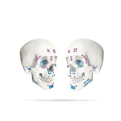 China Maxillofacial zelf-Boring van het Platensysteem & het Onttrekken van Schroeven Te koop