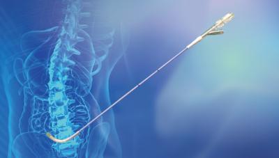 China Percutaneous Curved Kyphoplasty System PCKP Unilateral Puncture Integrally Forming for sale