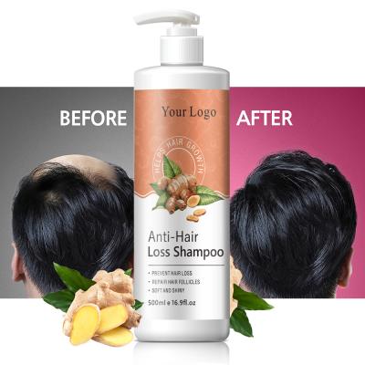 China Brittle Natural Organic Hair Care High Demand Anti Loss Prevention Hair Loss Regrowth Shampoo for sale