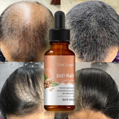 China Loss Prevention Damaged Hair Repair And Regrowth Product 30ml Deep Hair Growth Serum for sale