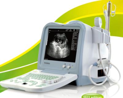 China KX2600 portable dignostic ultrasound scanner for sale