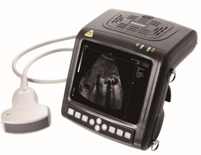 China KX5200 full- digital portable human diagnostic ultrasound scanner for sale