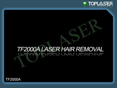 China Máquina da remoção do cabelo do laser do Nd Yag para o cabelo de axila, nenhuns efeitos secundários à venda