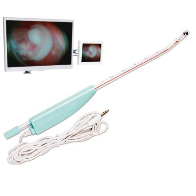 China Disposable Disposable Visual Endoscopic Suction Tube With Optical Camera For Surgical Abortion for sale