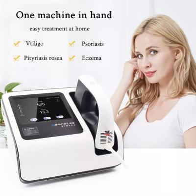 China Psoriasis 308nm Vitiligo Excimer Core Vitiligo Laser UVB Laser UVB Vitiligo Core ODM ODM Excimer 308nm Mini Laser New Technology 2020 for sale