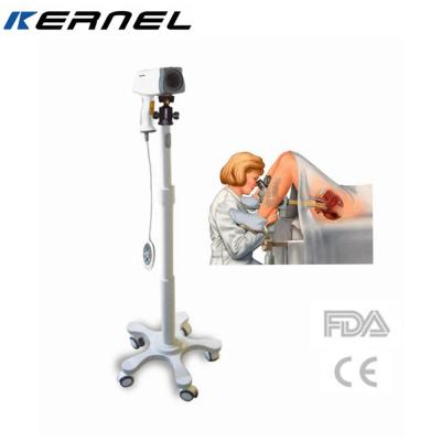 China 0.8 Million Colposcope For Gynecology Colposcopy Camera Sony Camera Digital Colposcope Video Colposcope For Gynecology for sale