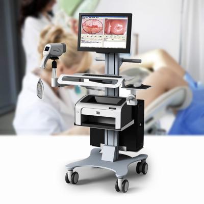 China High resolution full core colposcopy examination surgical instruments hd camera colposcope price equipment for gynecology with software for sale