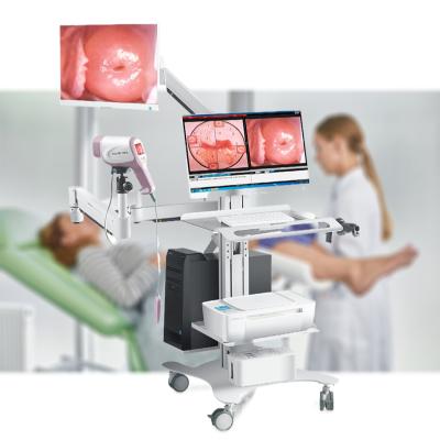 China 3.27 Million Core KN-2200IH Gynecology Sony CCD Video Colposcope 20MG Pixel Trolley Cheap Electronic Model for sale