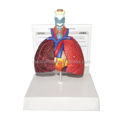 China Realistic Human Lung Anatomy Model Human Simulation Respiratory System Anatomy Model for sale