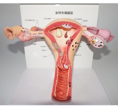 China Top Quality Realistic Human Simulation Human Uterus And Ovary Pathology Model for sale