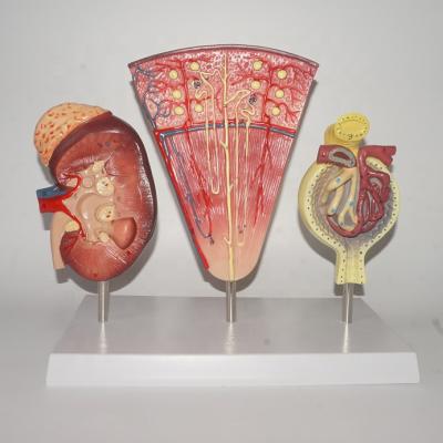 China Realistic Human Simulation Anatomy Nephron Model, Kidney Model, Renal Corpuscle Model for sale