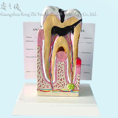 China Realistic Human Simulation Pathological Human Medical Dental Teeth Anatomical Model R080104 for sale