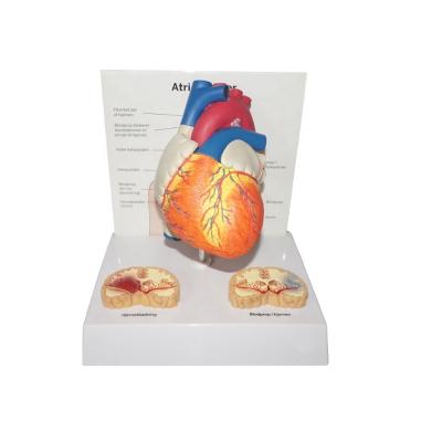 China Realistic Human Simulation Human Atrial Fibrillation Teaching Heart Anatomical Model for sale