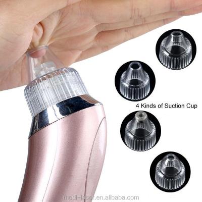 China Plastic USB Rechargeable Electric Blackhead Vacuumtool Device for sale