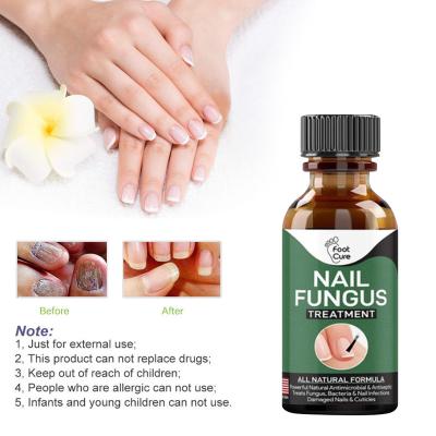 China Nail Treatment 10ml Fungus Foot Treatment 10ml for sale