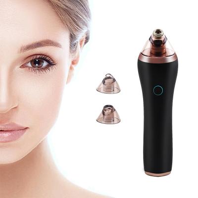 China Blackheads Acne Treatment Blackheads Cleaner Removal HD App Clear Pore Vacuum Blackhead Remover for sale