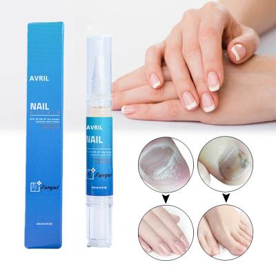 China Easy Apply Herbal Nail Repair Pen Nourishing Renew Nail Fungal Nail Treatment Cuticle Oil Liquid Pen for sale