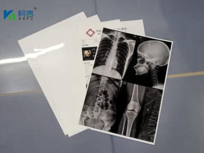 China Radiology Films x rays Medical x-ray White Film For Digital Printing zu verkaufen