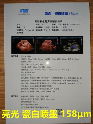 Cina 125 Microns White Base Opaque Inkjet Medical Film Three Dimensional CT Scan Film in vendita