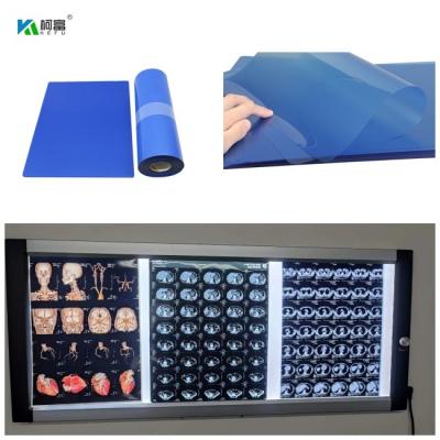 Cina 210microns Inkjet Medical X Ray Film For CT DR MRI  And 3D CT MRI Image Output 14x17 in vendita