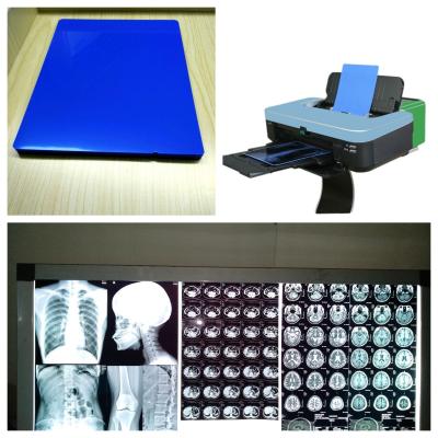 China Inkjet X-ray filmplaten 8x10 10x12 11x14 14x17 A4 A3 A3+ 13X17 Met druksnelheid 1-3 minuten Te koop