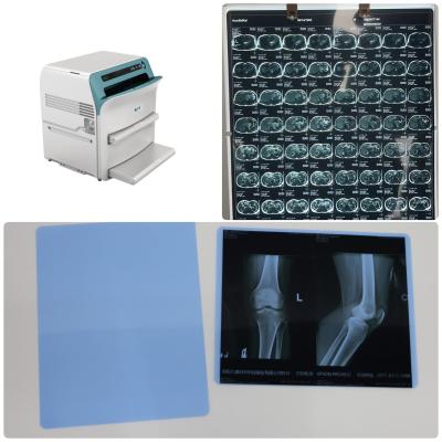 China 14x17 Efficient Medical X Ray Film With Moisture Resistance For Professionals Te koop