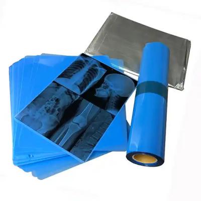 China High Grade Medical X-ray Dry Blue Film For Inkjet for sale