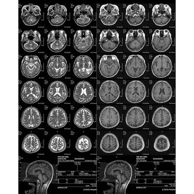 Chine Film de radiographie médicale à usage unique réglé automatiquement en fonction de la densité à vendre