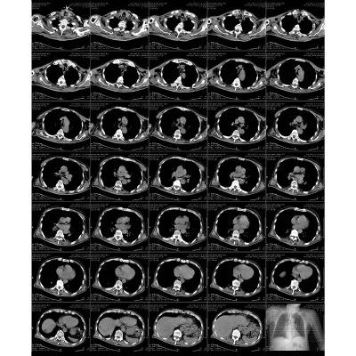 Chine Film laser radiographique imprimable à laser bleu avancé avec procédé d'impression thermique à vendre