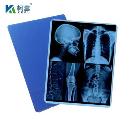 China Medical Blue Inkjet Based Dry Imaging Xray Film Pet Blue Base Film For Making X-Ray Film Epson HP Printers for sale