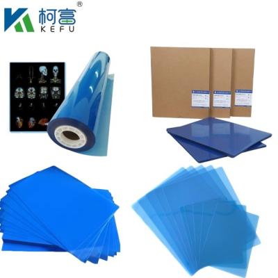 China Customized Size Blue PET Based X Ray Inkjet/ Laser Film Medical Images For Clinic And Hospitals for sale