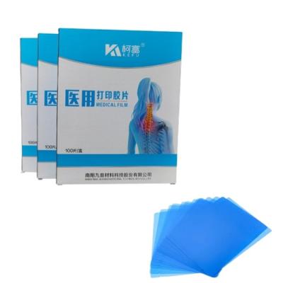 China Customized Size Hot Selling Blue White Inkjet Medical Film X-ray Film For Inkjet Printers In Sheets for sale