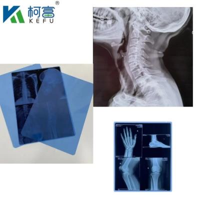 China Medical X Ray Film Dry Blue Inkjet Film CT DR Film A4 8x10 Sheet Or Roll For Medical Inkjet Printing Media for sale