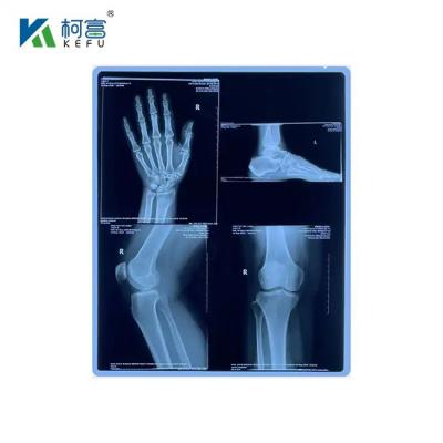 China Blue PET Based X Ray Inkjet / Laser Film Medical Images For Clinic And Hospitals for sale