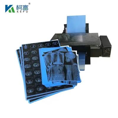 China Medical Printing Radiology Universal Dry Film / 14*17 Inch Medical Blue Thermal Film / X-Ray Printer Hospital Film for sale